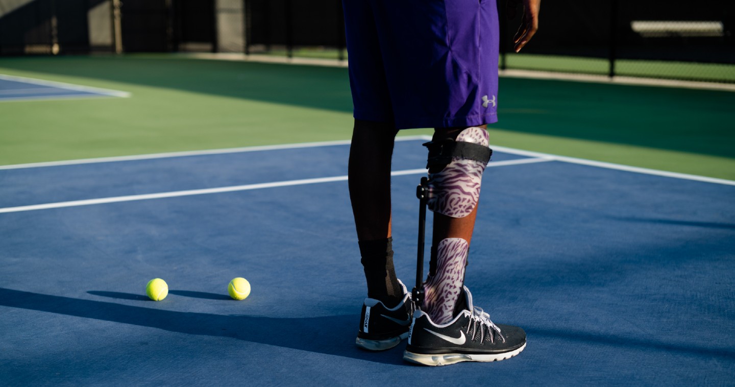Kel's leg on tennis court