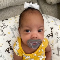 Patient Brielle Grace with pacifier 