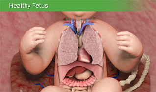 Healthy Fetus