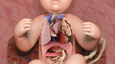 Congenital Diaphragmatic Hernia Chest View