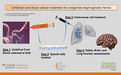 CDH Umbilical Cord Research