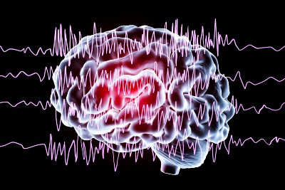 brain waves with epilepsy