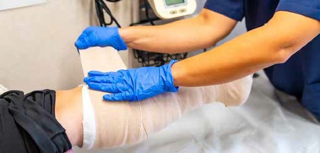 A nurse dresses a leg wound.