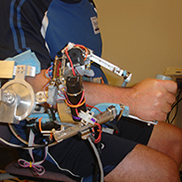 Patient Rehabilitating Arm