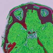 Imaging scan of brain